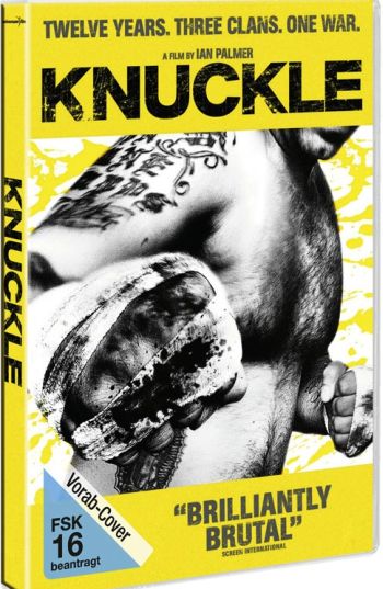 Knuckle