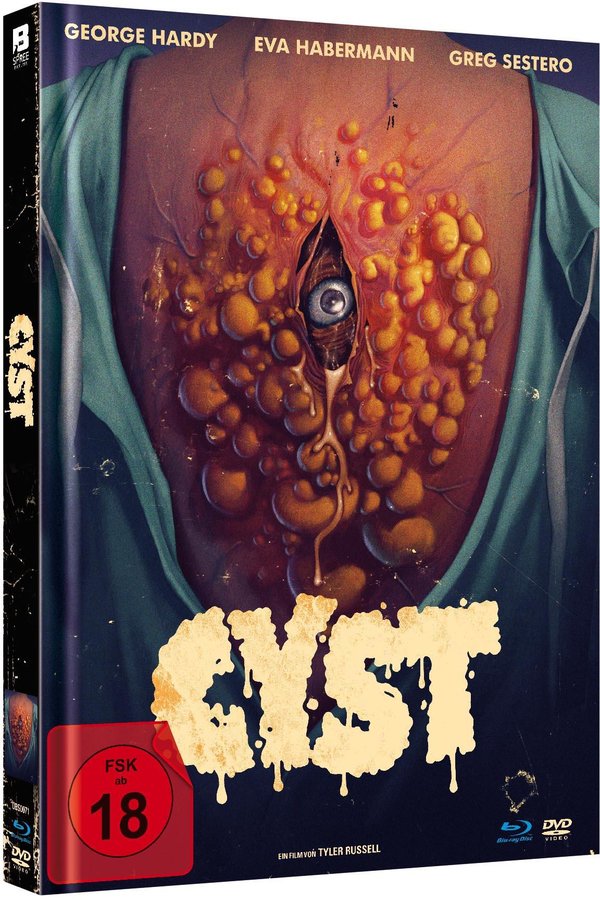 Cyst - Uncut Mediabook Edition (DVD+blu-ray)